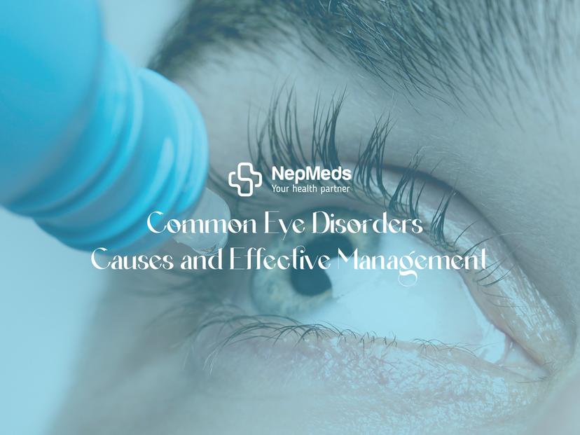 Common Eye Disorders: Causes and Effective Management