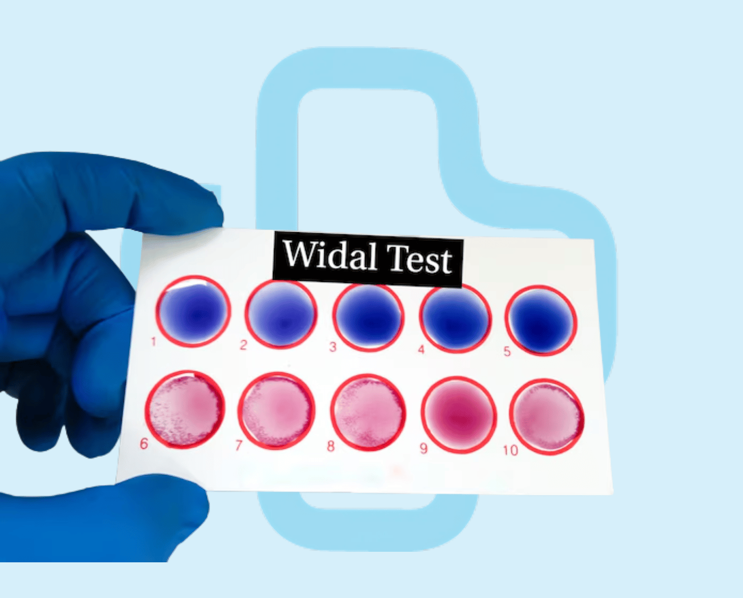 Widal Test : NepMeds