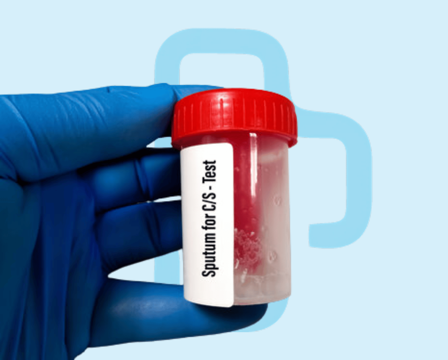 Sputum C/S