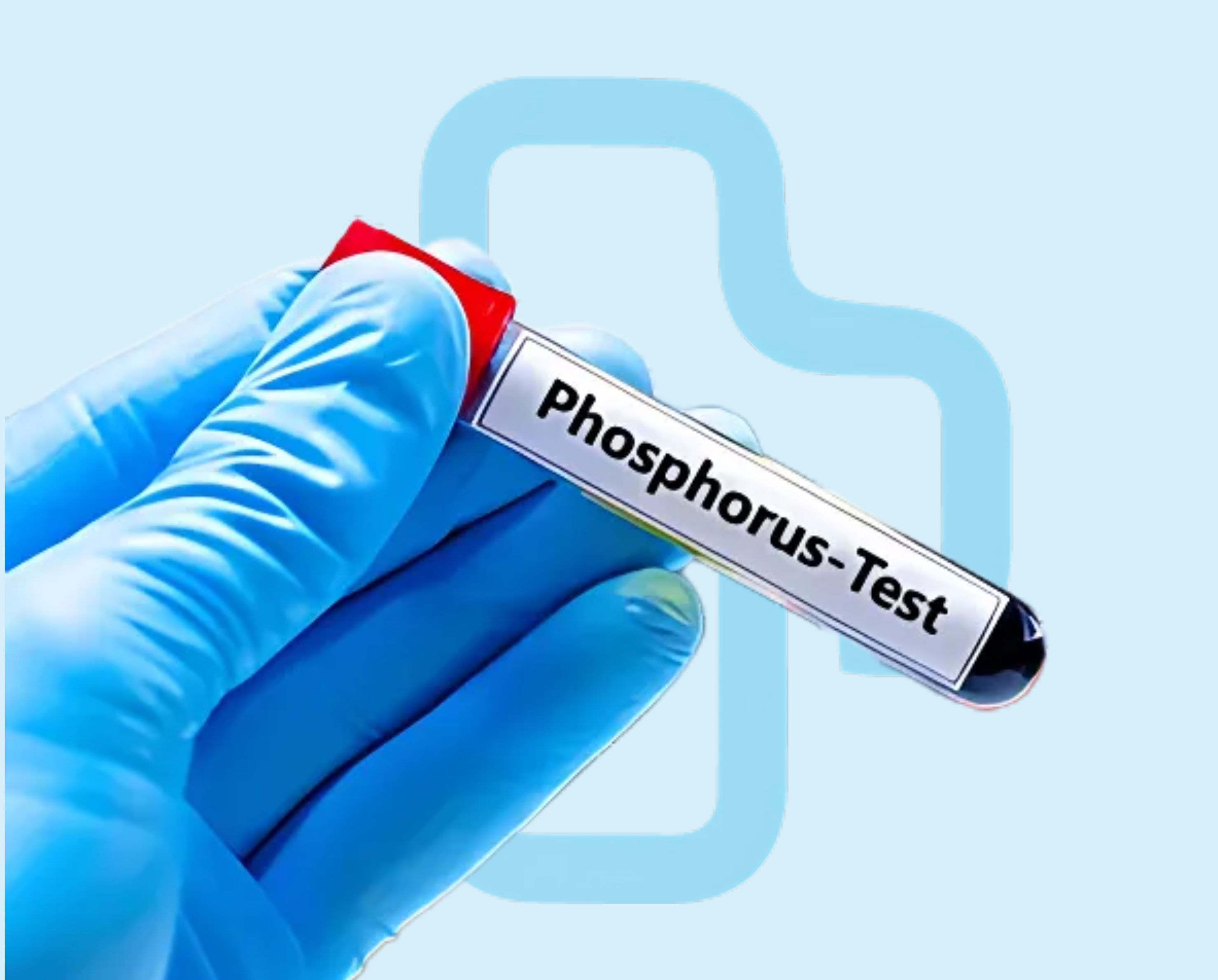 Phos Lab Test Phosphorus : NepMeds
