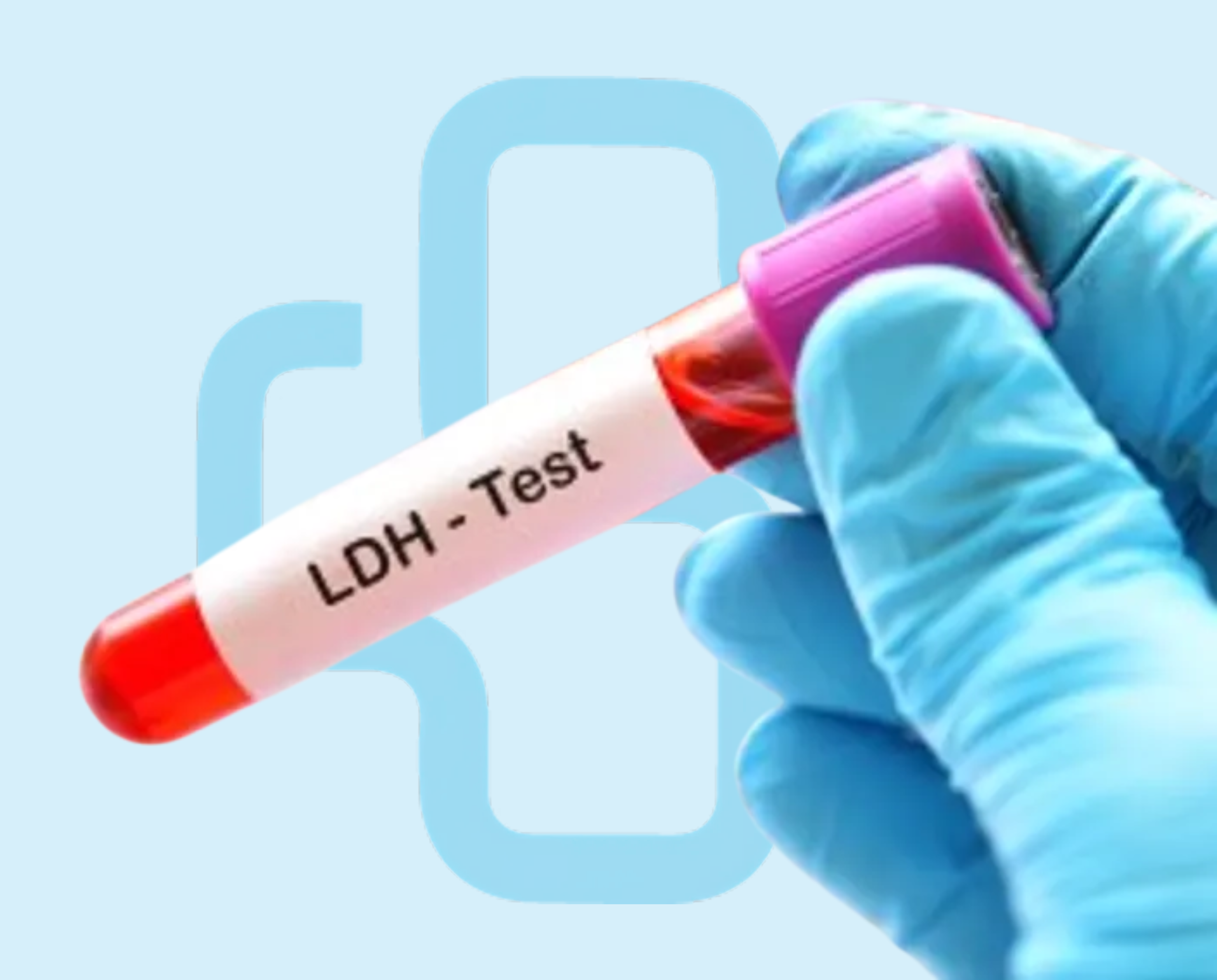 Ldh Lab Testing Lactate Dehydrogenase : NepMeds