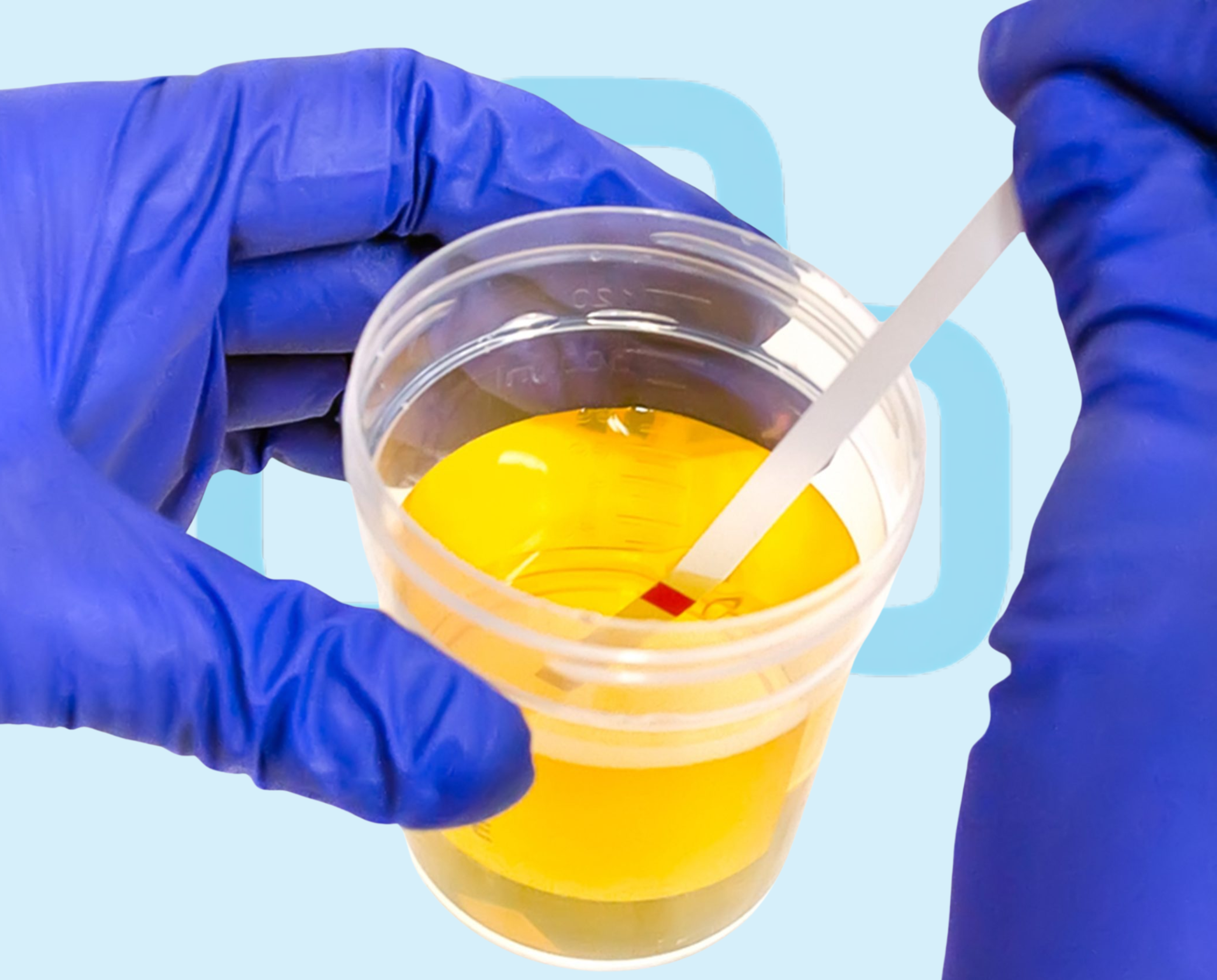 urine R/E